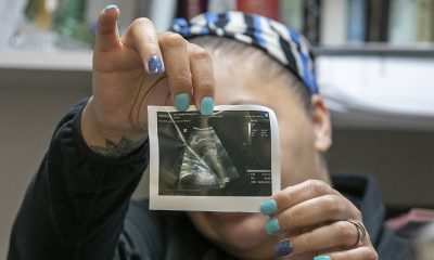 Hungarian women must hear foetus' heartbeat before abortion decision