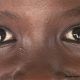 World Sight Day: Lagos offers free eye surgery to 30,000 residents –Commissioner