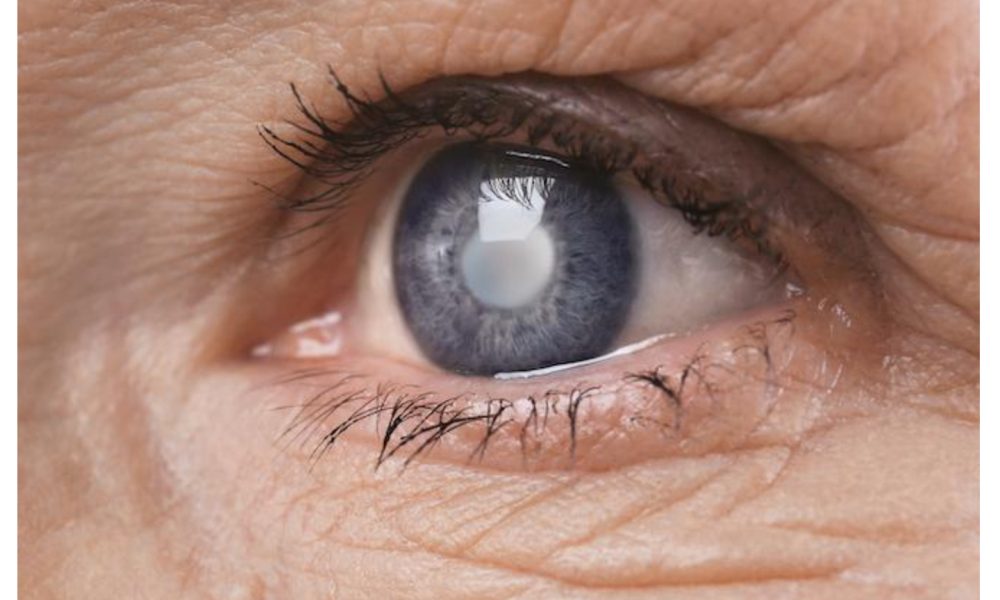How to prevent sudden blindness from glaucoma —Ophthalmologists