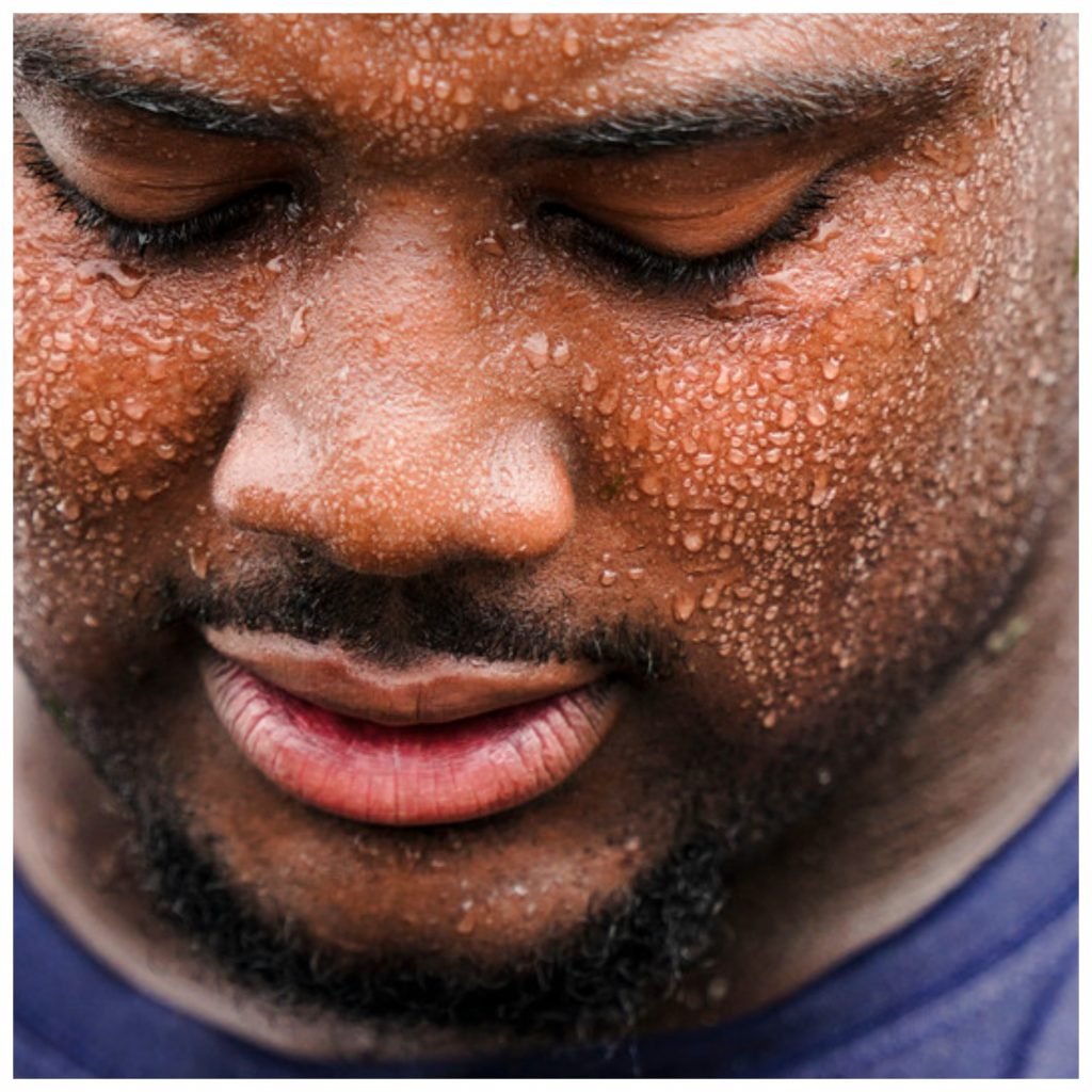 Experts link excessive sweating to diabetes, nervous disorders