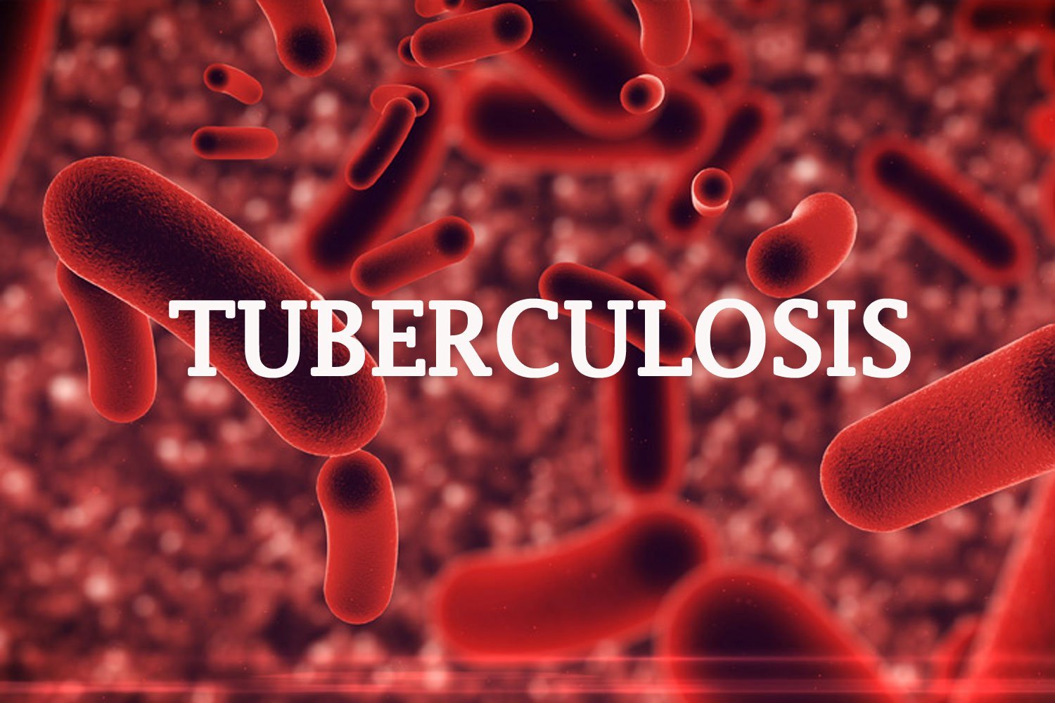 Tuberculosis not caused by witchcraft, poison - WHO