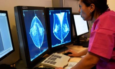 Queen’s University researchers working on cutting-edge breast cancer research - Kingston