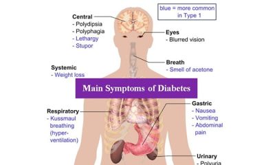 11 million Nigerians have undiagnosed diabetes, experts project double by 2045