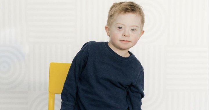Young Calgary boy becomes face of Down syndrome campaign