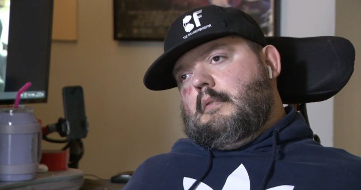 ‘I felt like I was in a MMA fight’: Disabled B.C. man shares horrible Air Canada experience - BC