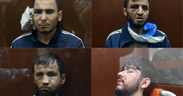 Moscow attack suspects appear beaten in court, raising questions of torture - National