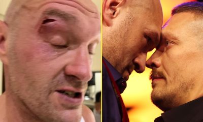 'It hasn't healed properly' - Tyson Fury warned cut will re-open against Oleksandr Usyk by veteran cutwoman
