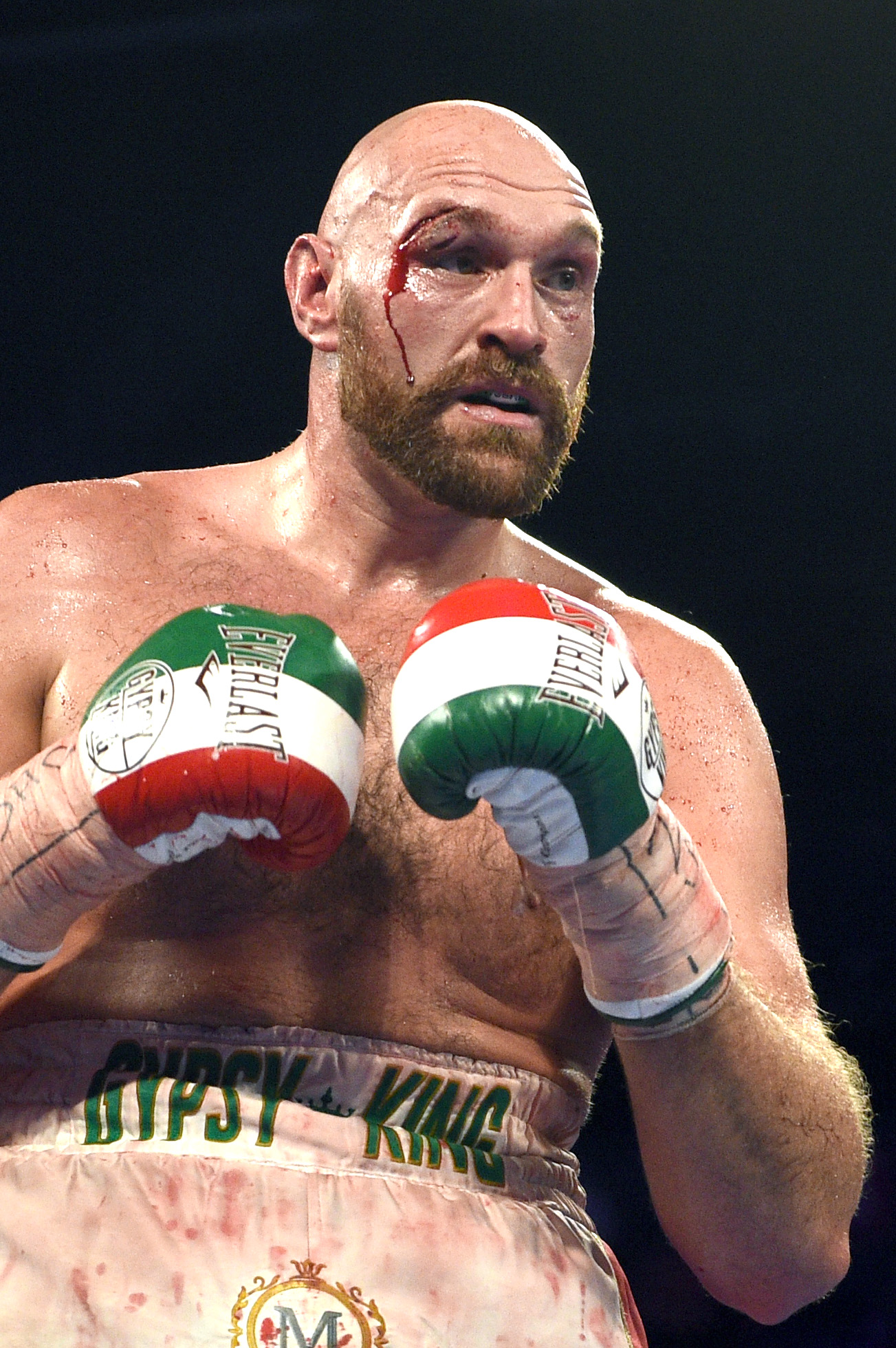Fury sustained two cuts in the same area against Wallin in 2019